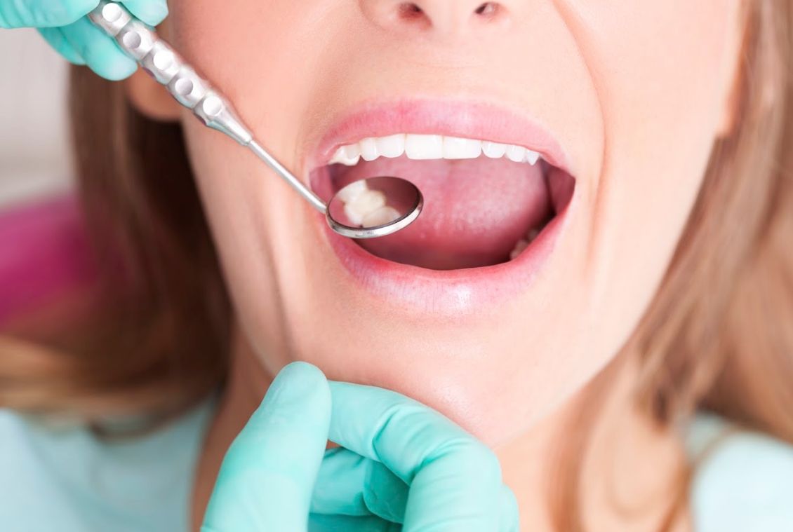 Odontología general: Servicios de Clínica Dental Doctora Cruz }}